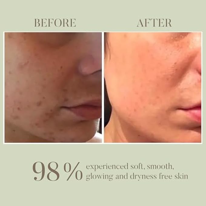 OHRIA AYURVEDA SHRIKAMYA FACIAL OIL | SKIN BRIGHTENING SERUM, 10ML - Image 3